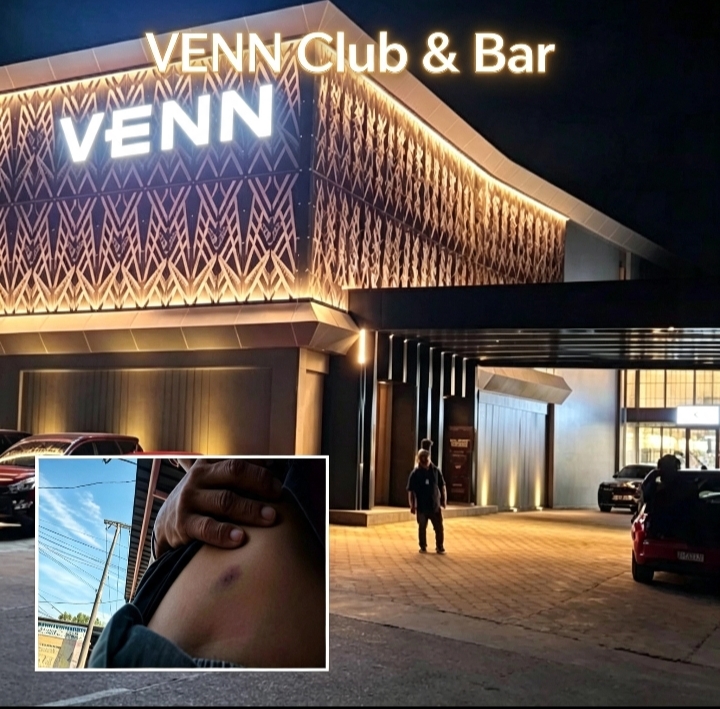 Pengunjung Sinyalir Dihajar Petugas Keamanan Hingga Memar , Pihak Management Venn Club Dan Bar Hanya Kata Maaf Tanpa Bertanggung Jawab